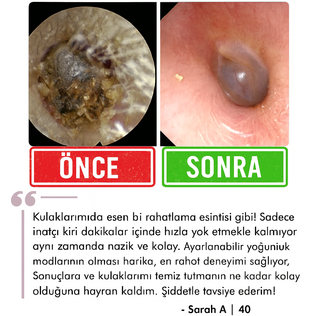 Gereley® - Elektrikli Kulak Temizleme Cihazı